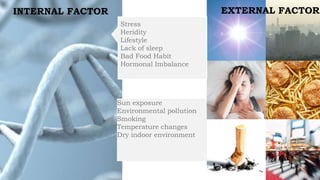 Stress
Heridity
Lifestyle
Lack of sleep
Bad Food Habit
Hormonal Imbalance
Sun exposure
Environmental pollution
Smoking
Temperature changes
Dry indoor environment
INTERNAL FACTOR EXTERNAL FACTOR
 