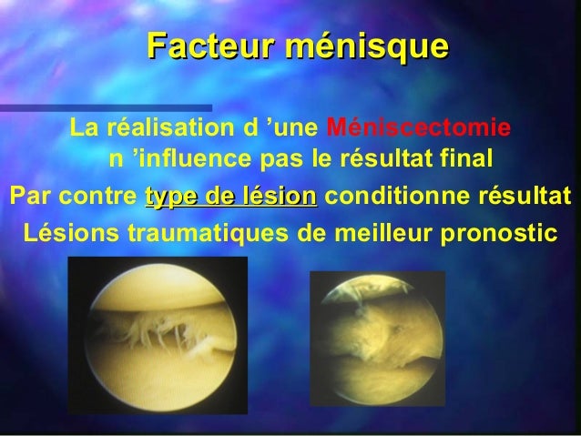 gonoise fusion