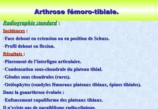 Arthrose fémoro-tibiale.Arthrose fémoro-tibiale.
Radiographie standardRadiographie standard ::
IncidencesIncidences ::
-Face debout en extension ou en position de Schuss.Face debout en extension ou en position de Schuss.
-Profil debout en flexion.Profil debout en flexion.
RésultatsRésultats ::
-Pincement de l’interligne articulaire.Pincement de l’interligne articulaire.
-Condensation sous-chondrale du plateau tibial.Condensation sous-chondrale du plateau tibial.
-Géodes sous chondrales (rares).Géodes sous chondrales (rares).
-Ostéophytes (condyles fémoraux plateaux tibiaux, épines tibiales).Ostéophytes (condyles fémoraux plateaux tibiaux, épines tibiales).
Dans la gonarthrose évoluée :Dans la gonarthrose évoluée :
-Enfoncement cupuliforme des plateaux tibiaux.Enfoncement cupuliforme des plateaux tibiaux.
Il n’existe pas de parallélisme radio-clinique.
 