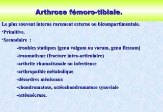 Arthrose fémoro-tibiale.Arthrose fémoro-tibiale.
Le plus souvent interne rarement externe ou bicompartimentale.Le plus souvent interne rarement externe ou bicompartimentale.
•Primitive.Primitive.
•Secondaire :Secondaire :
-troubles statiques [genu valgum ou varum, genu flessum]-troubles statiques [genu valgum ou varum, genu flessum]
-traumatisme (fracture intra-articulaire)-traumatisme (fracture intra-articulaire)
-arthrite rhumatismale ou infectieuse-arthrite rhumatismale ou infectieuse
-arthropathie métabolique-arthropathie métabolique
-désordres méniscaux-désordres méniscaux
-chondromatose, ostéochondromatose synoviale-chondromatose, ostéochondromatose synoviale
-ostéonécrose.-ostéonécrose.
 