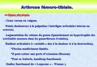 Arthrose fémoro-tibiale.Arthrose fémoro-tibiale.
⇒⇒SiSiggnesnes pphysihysiqquesues..
- Genu varum ou valgum.- Genu varum ou valgum.
-Points douloureux à la palpation ( interligne articulaire interne ouPoints douloureux à la palpation ( interligne articulaire interne ou
externe).externe).
-Augmentation du volume du genou (épanchement ou hypertrophie desAugmentation du volume du genou (épanchement ou hypertrophie des
extrémités osseuses dans les gonarthroses évoluées).extrémités osseuses dans les gonarthroses évoluées).
-Raideur articulaire (« variable » due à la douleur et à la destruction),Raideur articulaire (« variable » due à la douleur et à la destruction),
Flexion modérément limitée.Flexion modérément limitée.
Il peut exister une perte d’extension (flessum)Il peut exister une perte d’extension (flessum)
PeutPeut ⇒⇒ boiterie, handicap fonctionnel.boiterie, handicap fonctionnel.
(Indice fonctionnel de « Lequesne » – Womac ).(Indice fonctionnel de « Lequesne » – Womac ).
 
