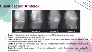 gonartrosis dra rosas.pptx