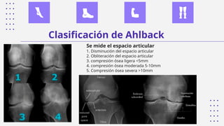 Lesiones en adultos mayores. Gonartrosis y coxartrosis. | PPTX