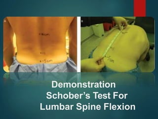Demonstration
Schober’s Test For
Lumbar Spine Flexion
 