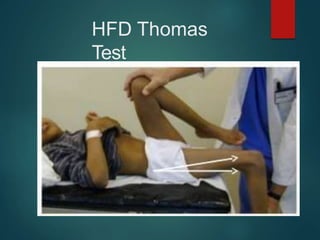 HFD Thomas
Test
 