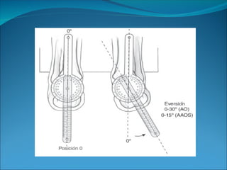 goniometria-111109111428-php55555app02.ppt