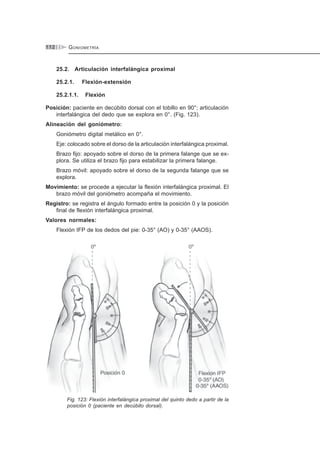 GONIOMETRÍA112
25.2. Articulación interfalángica proximal
25.2.1. Flexión-extensión
25.2.1.1. Flexión
Posición: paciente en decúbito dorsal con el tobillo en 90°; articulación
interfalángica del dedo que se explora en 0°. (Fig. 123).
Alineación del goniómetro:
Goniómetro digital metálico en 0°.
Eje: colocado sobre el dorso de la articulación interfalángica proximal.
Brazo fijo: apoyado sobre el dorso de la primera falange que se ex-
plora. Se utiliza el brazo fijo para estabilizar la primera falange.
Brazo móvil: apoyado sobre el dorso de la segunda falange que se
explora.
Movimiento: se procede a ejecutar la flexión interfalángica proximal. El
brazo móvil del goniómetro acompaña el movimiento.
Registro: se registra el ángulo formado entre la posición 0 y la posición
final de flexión interfalángica proximal.
Valores normales:
Flexión IFP de los dedos del pie: 0-35° (AO) y 0-35° (AAOS).
Fig. 123: Flexión interfalángica proximal del quinto dedo a partir de la
posición 0 (paciente en decúbito dorsal).
 