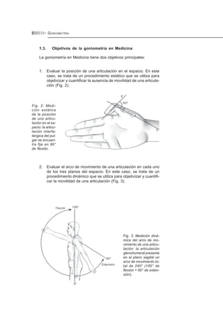 GONIOMETRÍA2
1.3. Objetivos de la goniometría en Medicina
La goniometría en Medicina tiene dos objetivos principales:
1. Evaluar la posición de una articulación en el espacio. En este
caso, se trata de un procedimiento estático que se utiliza para
objetivizar y cuantificar la ausencia de movilidad de una articula-
ción (Fig. 2).
Fig. 2: Medi-
ción estática
de la posición
de una articu-
lación en el es-
pacio: la articu-
lación interfa-
lángica del pul-
gar se encuen-
tra fija en 80°
de flexión.
2. Evaluar el arco de movimiento de una articulación en cada uno
de los tres planos del espacio. En este caso, se trata de un
procedimiento dinámico que se utiliza para objetivizar y cuantifi-
car la movilidad de una articulación (Fig. 3).
Fig. 3: Medición diná-
mica del arco de mo-
vimiento de una articu-
lación: la articulación
glenohumeral presenta
en el plano sagital un
arco de movimiento to-
tal de 240° (180° de
flexión + 60° de exten-
sión).
 