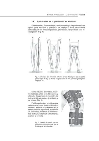 PARTE I. INTRODUCCIÓN A LA GONIOMETRÍA 3
1.4. Aplicaciones de la goniometría en Medicina
En Ortopedia y Traumatología y en Reumatología, la goniometría se
aplica para describir la presencia de desejes a nivel del sistema
osteoarticular con fines diagnósticos, pronósticos, terapéuticos y de in-
vestigación (Fig. 4).
Fig. 4: Desejes del miembro inferior: a) eje fisiológico de la rodilla
(geno valgo de 8°); b) deseje en geno varo de 20°, y c) deseje en geno
valgo de 25°.
En la industria biomédica, la go-
niometría se aplica en la fabricación y
el diseño de aparatos de medición, de
instrumental quirúrgico, de prótesis y
de ortesis (Fig. 5).
En Rehabilitación, se utiliza para
determinar el punto de inicio de un tra-
tamiento, evaluar su progresión en el
tiempo, motivar al paciente, establecer
un pronóstico, modificar el tratamien-
to o darle un punto final, y, finalmente,
evaluar la secuela.
Fig. 5: Ortesis de rodilla con re-
gulación goniométrica de la
flexión y de la extensión.
 