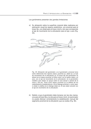 PARTE I. INTRODUCCIÓN A LA GONIOMETRÍA 31
Los goniómetros presentan dos grandes limitaciones:
a) Su alineación sobre la superficie corporal debe realizarse por
estimación visual de reparos anatómicos, uno proximal para el
brazo fijo, uno distal para el brazo móvil y otro que corresponde
al eje de movimiento de la articulación para el eje o axis (Fig.
35).
Fig. 35: Alineación del goniómetro: a) el goniómetro universal toma
como referencias tres reparos óseos: proximal (x), distal (z) y el eje
de movimiento de la articulación (y). El brazo fijo del goniómetro se
alinea con el reparo proximal; el brazo móvil, con el reparo distal, y el
axis, con el eje de movimiento de la articulación; b) el goniómetro
metálico para dedos se apoya sobre la cara dorsal o ventral de la
mano y del pie. Toma como reparo proximal (x) la diáfisis de los
metacarpianos (metatarsianos) o de la falange proximal, y como repa-
ro distal, la diáfisis de la falange distal (z). El axis debe coincidir con
el eje de movimiento de la articulación.
b) Debido a que el goniómetro debe tomarse con las dos manos,
una para el brazo fijo y la otra para el brazo móvil, el examinador
no puede efectuar correctamente la estabilización manual del
segmento proximal de la articulación que se evalúa (Fig. 36).
 