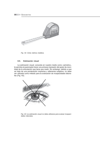 GONIOMETRÍA36
Fig. 42: Cinta métrica metálica.
8.5. Estimación visual
La estimación visual, conocida en nuestro medio como «ojímetro»,
le permite al examinador tener una primera impresión del grado de movi-
lidad de la articulación que tiene que medir. Sin embargo, debido a que
se trata de una ponderación imprecisa y altamente subjetiva, no debe
ser utilizada como método para la evaluación de incapacidades labora-
les (Fig. 43).
Fig. 43: La estimación visual no debe utilizarse para evaluar incapaci-
dades laborales.
 