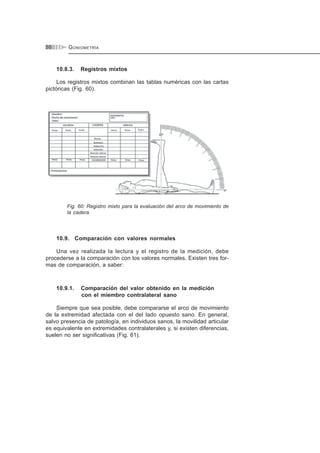GONIOMETRÍA50
10.8.3. Registros mixtos
Los registros mixtos combinan las tablas numéricas con las cartas
pictóricas (Fig. 60).
Fig. 60: Registro mixto para la evaluación del arco de movimiento de
la cadera.
10.9. Comparación con valores normales
Una vez realizada la lectura y el registro de la medición, debe
procederse a la comparación con los valores normales. Existen tres for-
mas de comparación, a saber:
10.9.1. Comparación del valor obtenido en la medición
con el miembro contralateral sano
Siempre que sea posible, debe compararse el arco de movimiento
de la extremidad afectada con el del lado opuesto sano. En general,
salvo presencia de patología, en individuos sanos, la movilidad articular
es equivalente en extremidades contralaterales y, si existen diferencias,
suelen no ser significativas (Fig. 61).
 