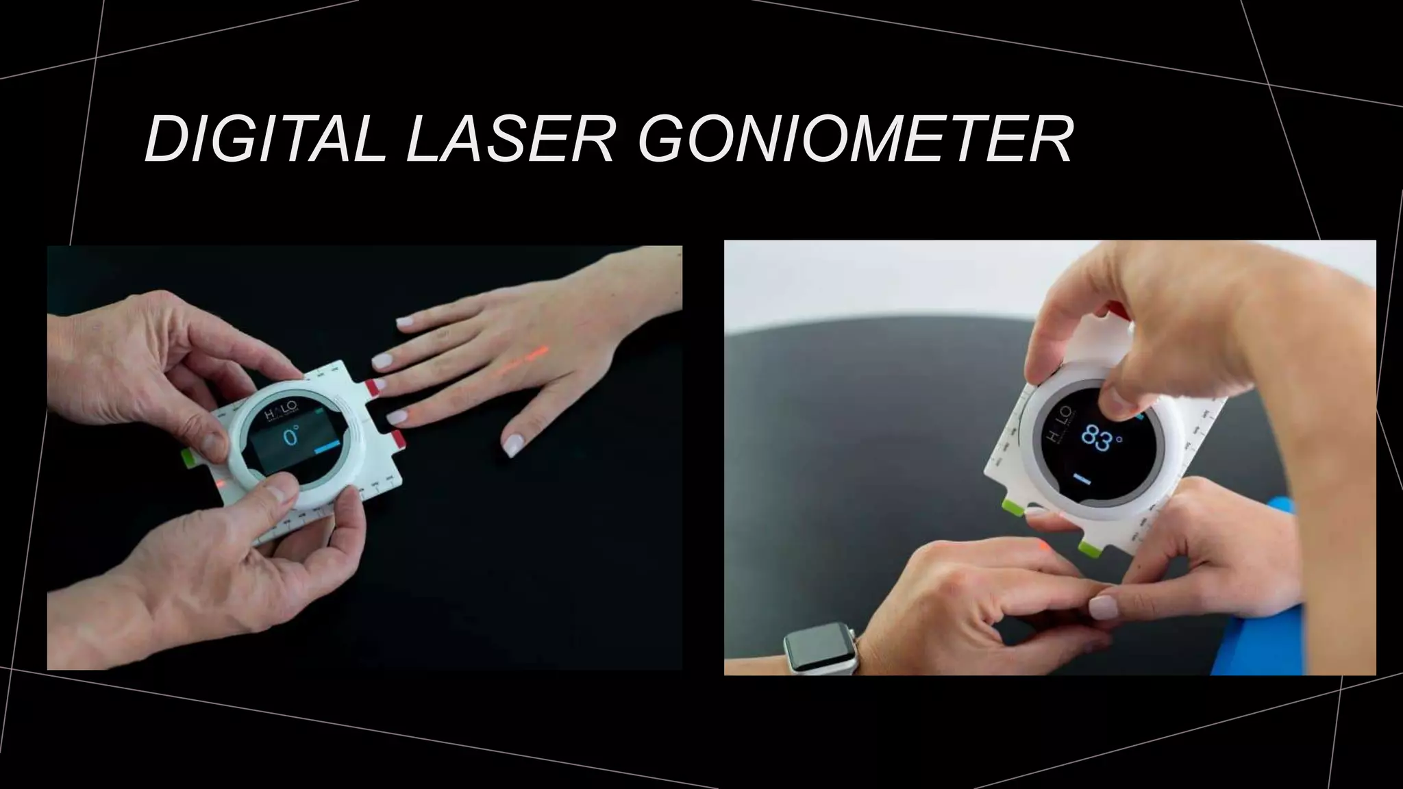 Goniometry for Wrist & Fingers | PPTX