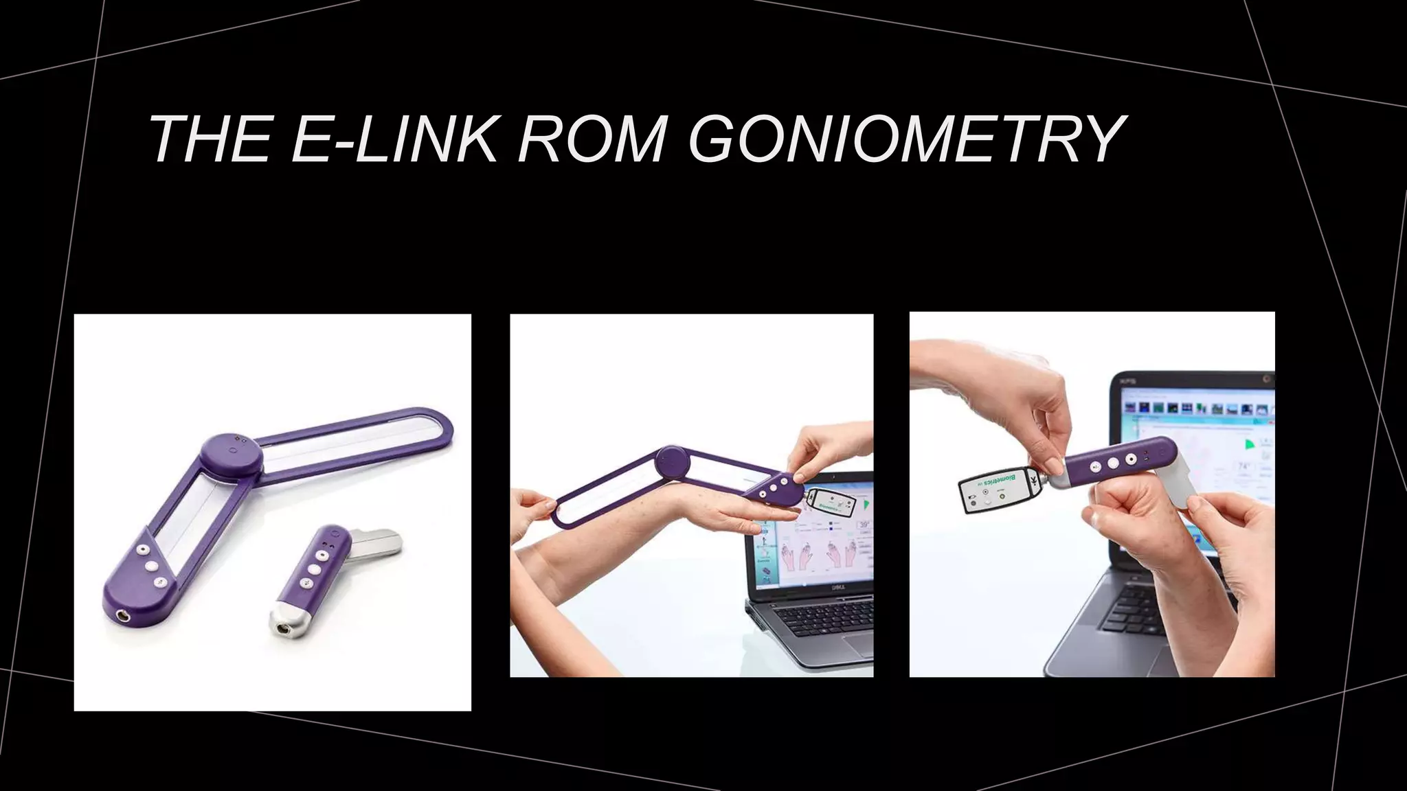 Goniometry for Wrist & Fingers | PPTX