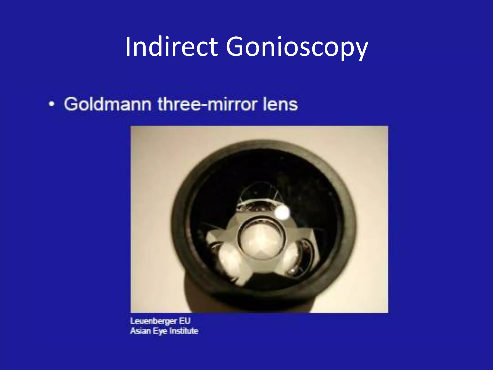 Indirect Gonioscopy

 