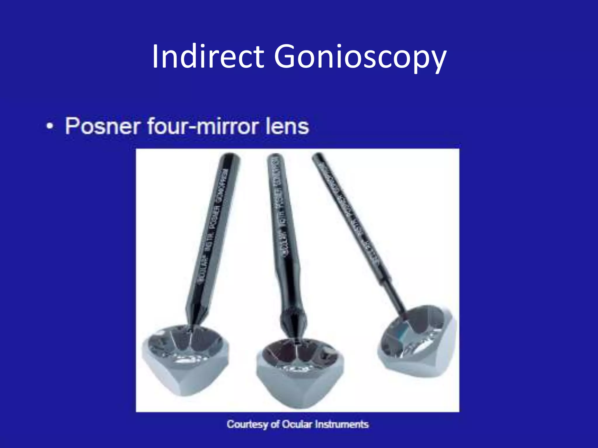 Indirect Gonioscopy

 