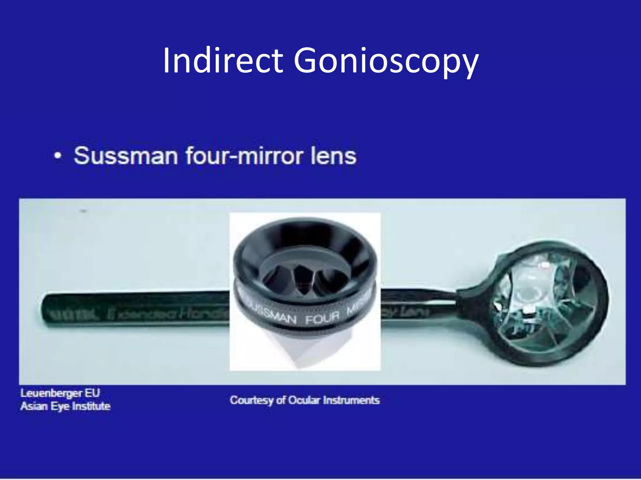 Indirect Gonioscopy

 