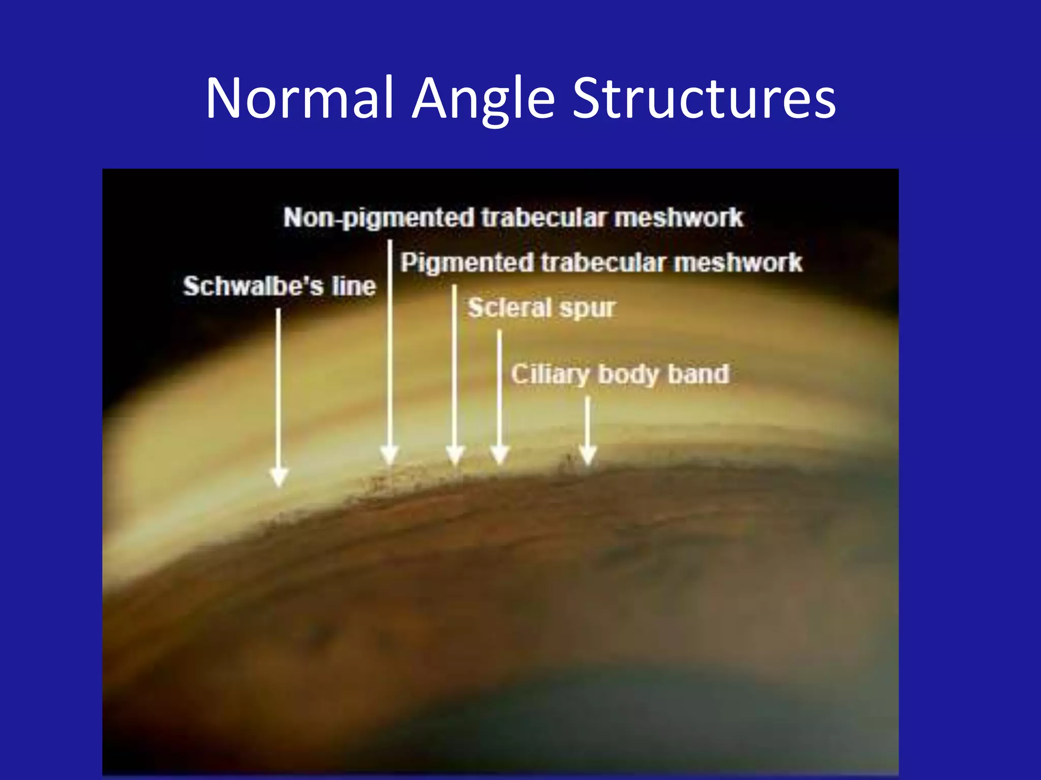 Normal Angle Structures

 