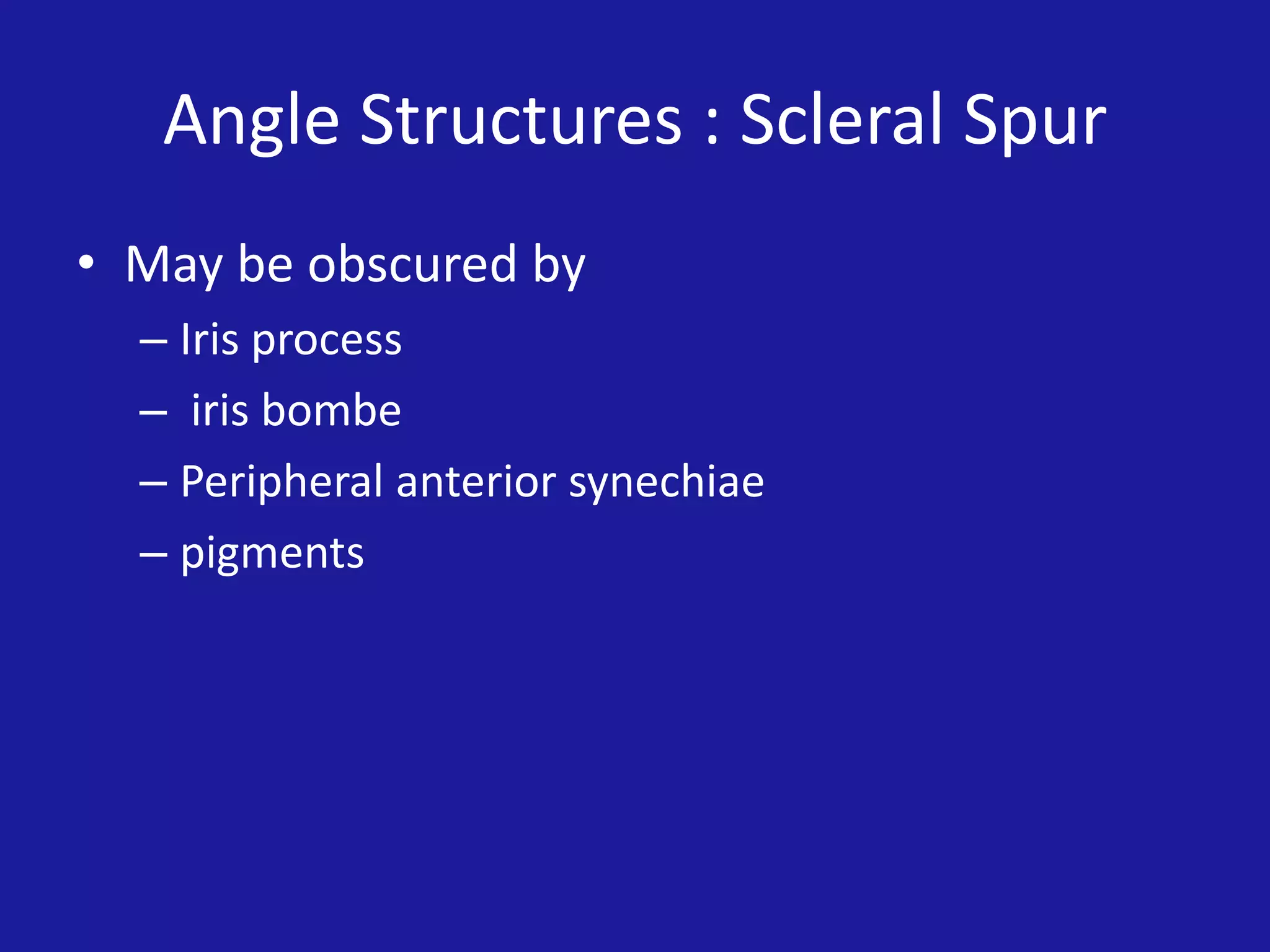 Angle Structures : Scleral Spur
• May be obscured by
– Iris process
– iris bombe
– Peripheral anterior synechiae
– pigments

 