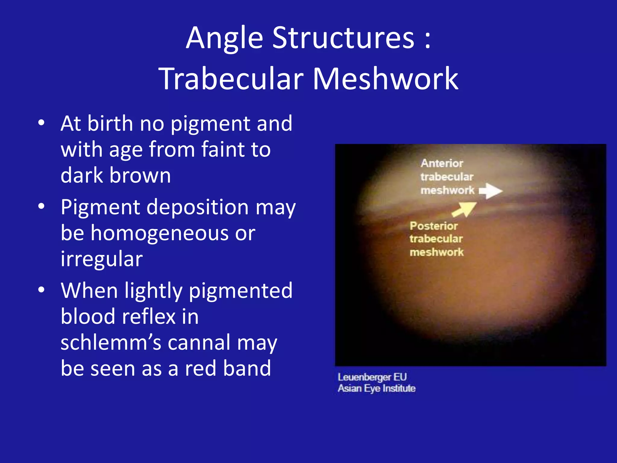 Angle Structures :
Trabecular Meshwork
• At birth no pigment and
with age from faint to
dark brown
• Pigment deposition may
be homogeneous or
irregular
• When lightly pigmented
blood reflex in
schlemm’s cannal may
be seen as a red band

 