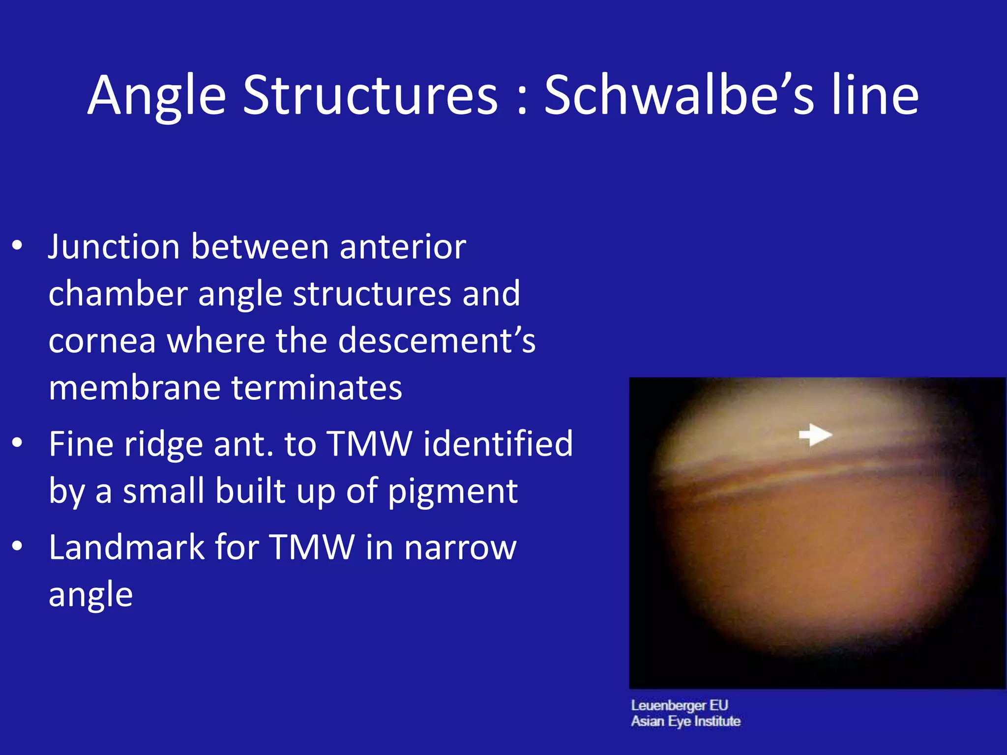 Angle Structures : Schwalbe’s line
• Junction between anterior
chamber angle structures and
cornea where the descement’s
membrane terminates
• Fine ridge ant. to TMW identified
by a small built up of pigment
• Landmark for TMW in narrow
angle

 