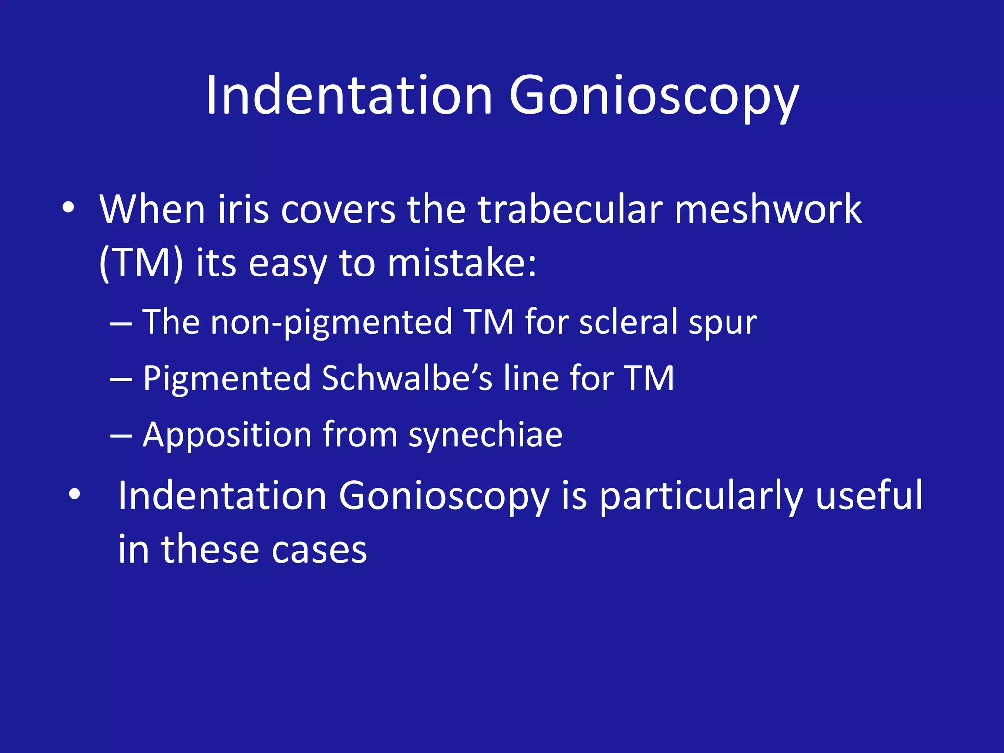 Indentation Gonioscopy
• When iris covers the trabecular meshwork
(TM) its easy to mistake:
– The non-pigmented TM for scleral spur
– Pigmented Schwalbe’s line for TM
– Apposition from synechiae

• Indentation Gonioscopy is particularly useful
in these cases

 