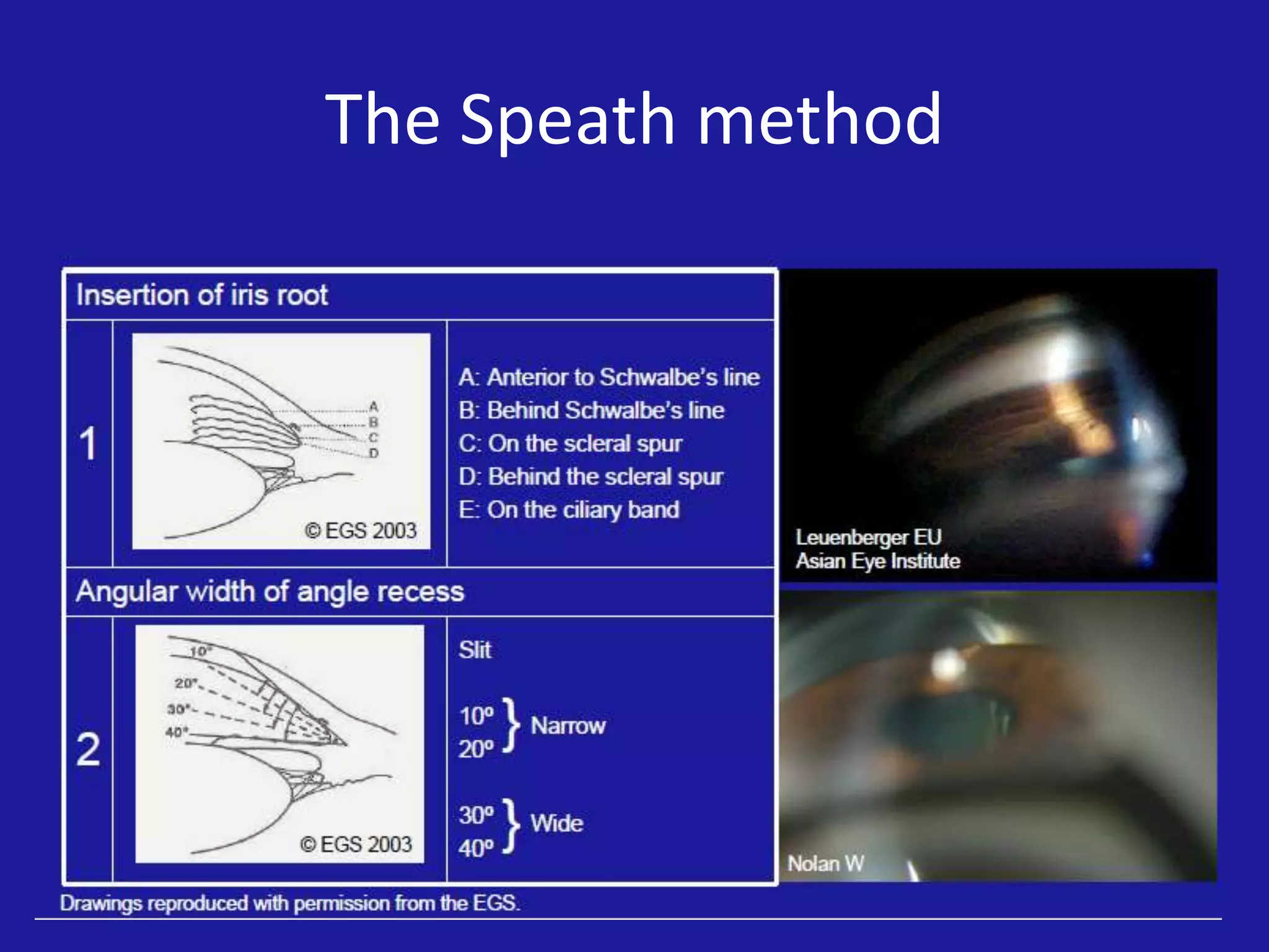 The Speath method

 