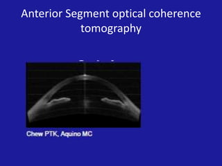 Anterior Segment optical coherence
tomography

 