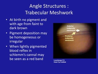 Angle Structures :
Trabecular Meshwork
• At birth no pigment and
with age from faint to
dark brown
• Pigment deposition may
be homogeneous or
irregular
• When lightly pigmented
blood reflex in
schlemm’s cannal may
be seen as a red band

 