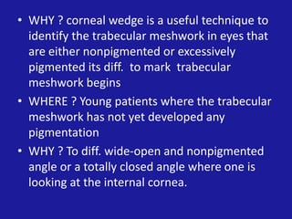 • WHY ? corneal wedge is a useful technique to
identify the trabecular meshwork in eyes that
are either nonpigmented or excessively
pigmented its diff. to mark trabecular
meshwork begins
• WHERE ? Young patients where the trabecular
meshwork has not yet developed any
pigmentation
• WHY ? To diff. wide-open and nonpigmented
angle or a totally closed angle where one is
looking at the internal cornea.

 