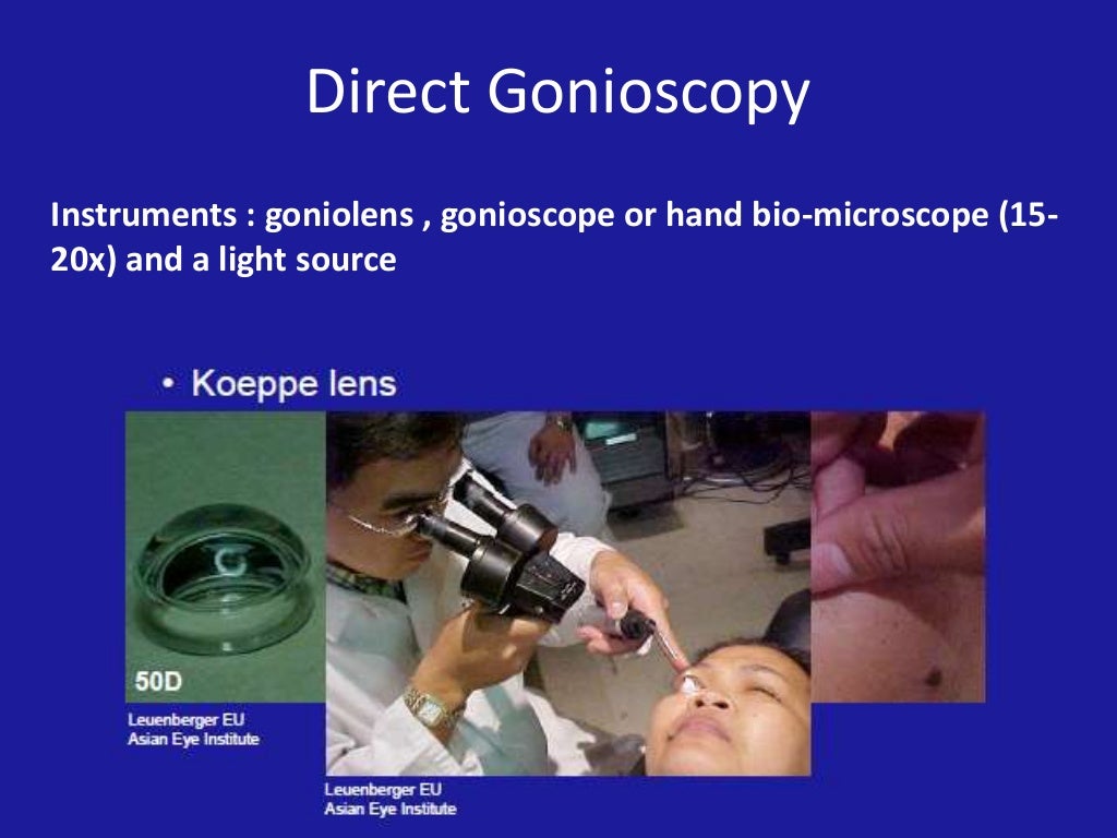 Gonioscopy