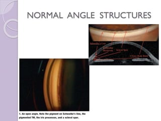 Gonioscopy | PPTX