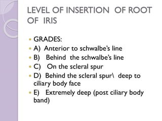 LEVEL OF INSERTION OF ROOT
OF IRIS
 GRADES:
 A) Anterior to schwalbe’s line
 B) Behind the schwalbe’s line
 C) On the scleral spur
 D) Behind the scleral spur deep to
ciliary body face
 E) Extremely deep (post ciliary body
band)
 