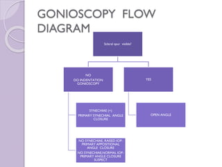 GONIOSCOPY FLOW
DIAGRAM
Scleral spur visible?
NO
DO INDENTATION
GONIOSCOPY
SYNECHIAE (+)
PRIMARY SYNECHIAL ANGLE
CLOSURE
NO SYNECHIAE, RAISED IOP-
PRIMARY APPOSITIONAL
ANGLE CLOSURE
NO SYNECHIAE,NORMAL IOP-
PRIMARY ANGLE CLOSURE
SUSPECT
YES
OPEN ANGLE
 