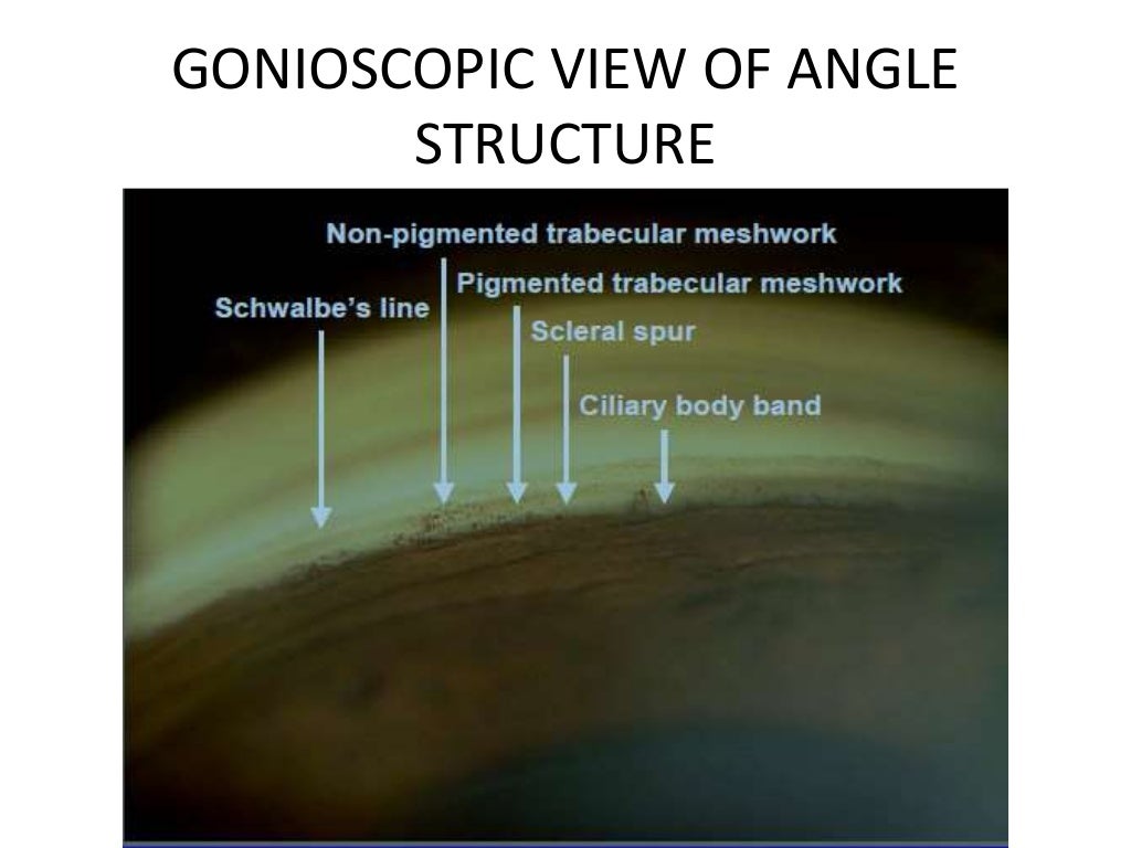 Gonioscopy