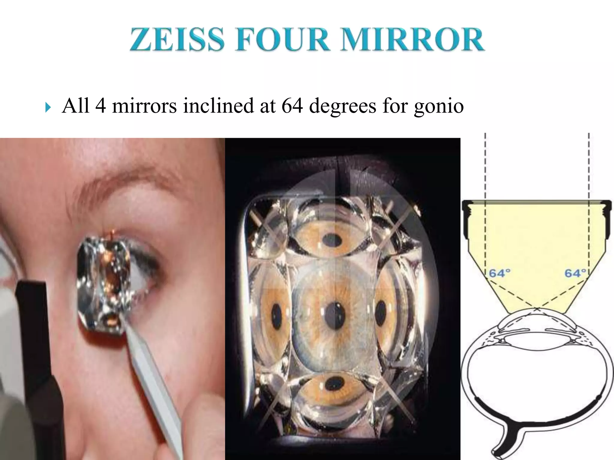  All 4 mirrors inclined at 64 degrees for gonio
 