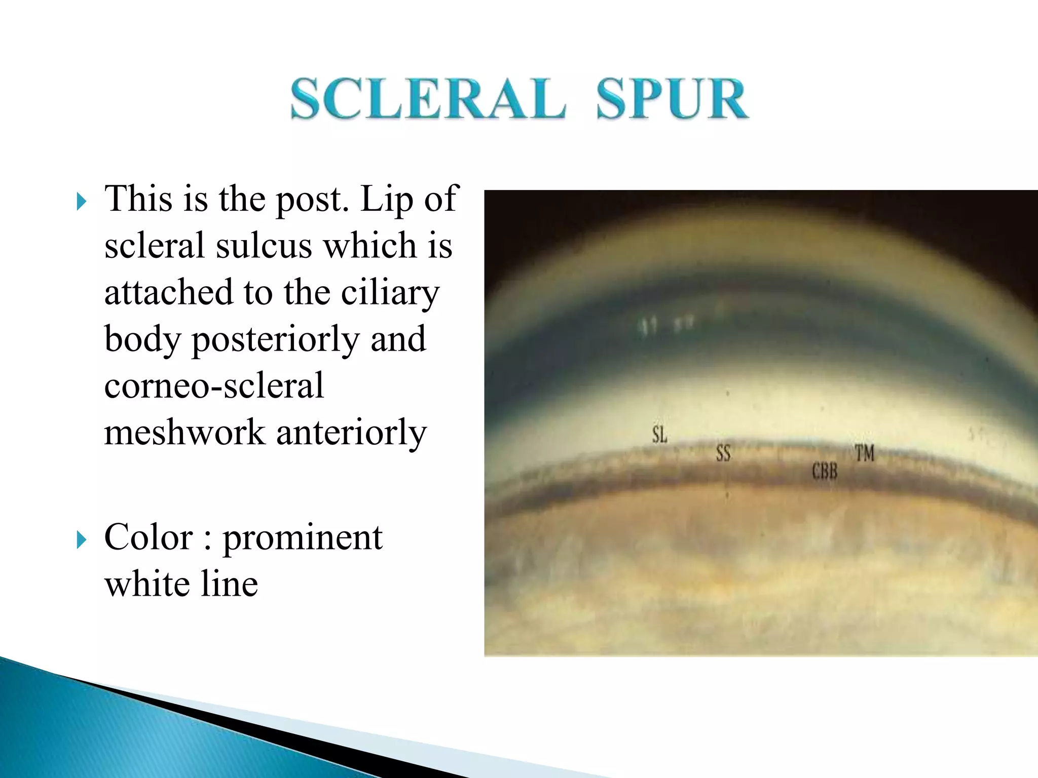 This is the post. Lip of
scleral sulcus which is
attached to the ciliary
body posteriorly and
corneo-scleral
meshwork anteriorly
 Color : prominent
white line
 