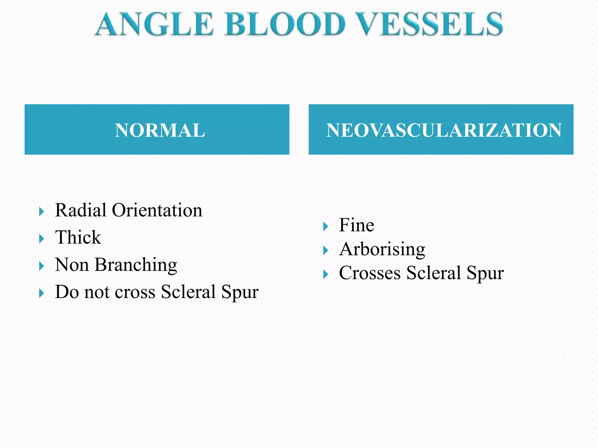 NORMAL NEOVASCULARIZATION
 Radial Orientation
 Thick
 Non Branching
 Do not cross Scleral Spur
 Fine
 Arborising
 Crosses Scleral Spur
 