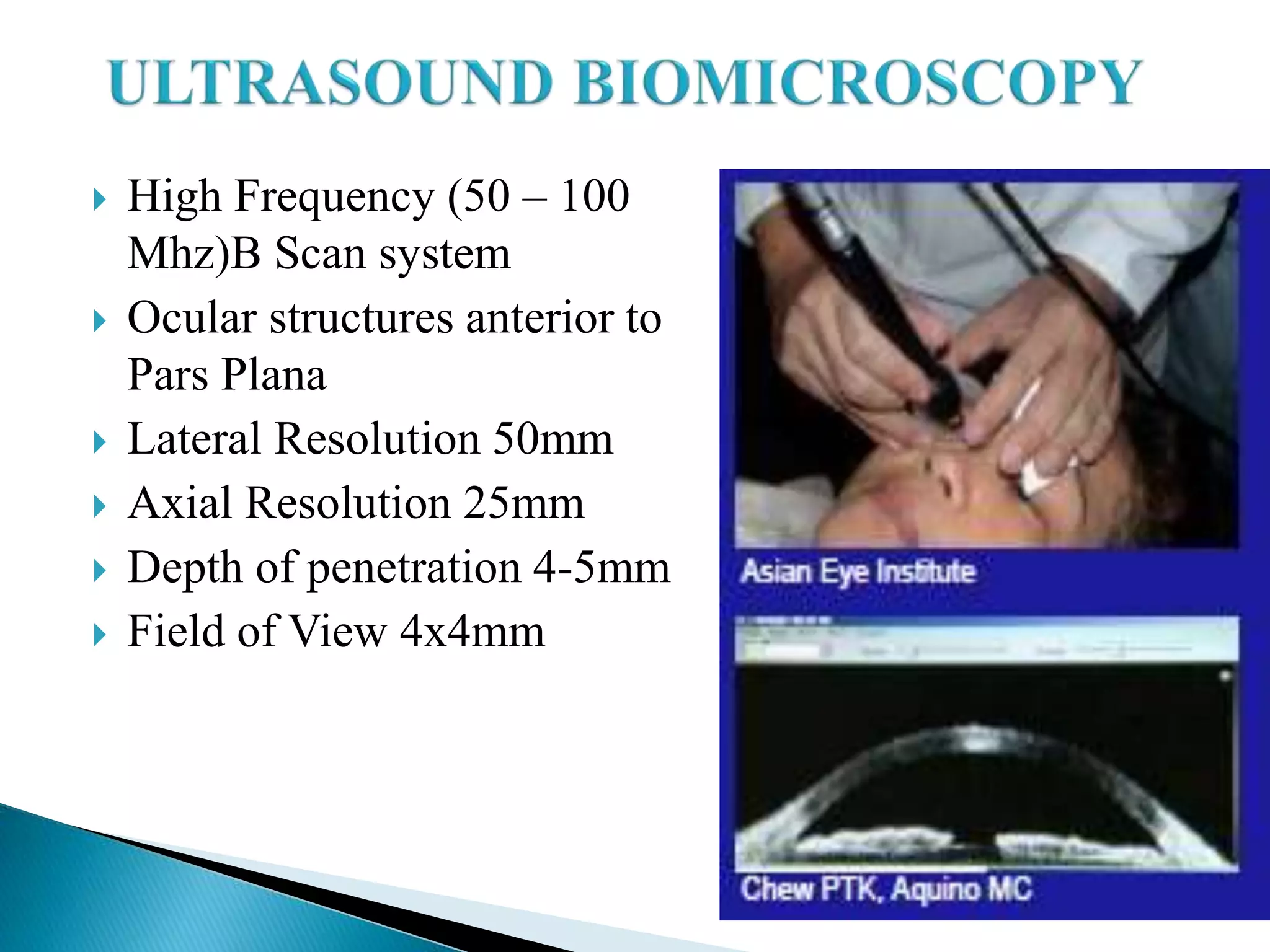  High Frequency (50 – 100
Mhz)B Scan system
 Ocular structures anterior to
Pars Plana
 Lateral Resolution 50mm
 Axial Resolution 25mm
 Depth of penetration 4-5mm
 Field of View 4x4mm
 