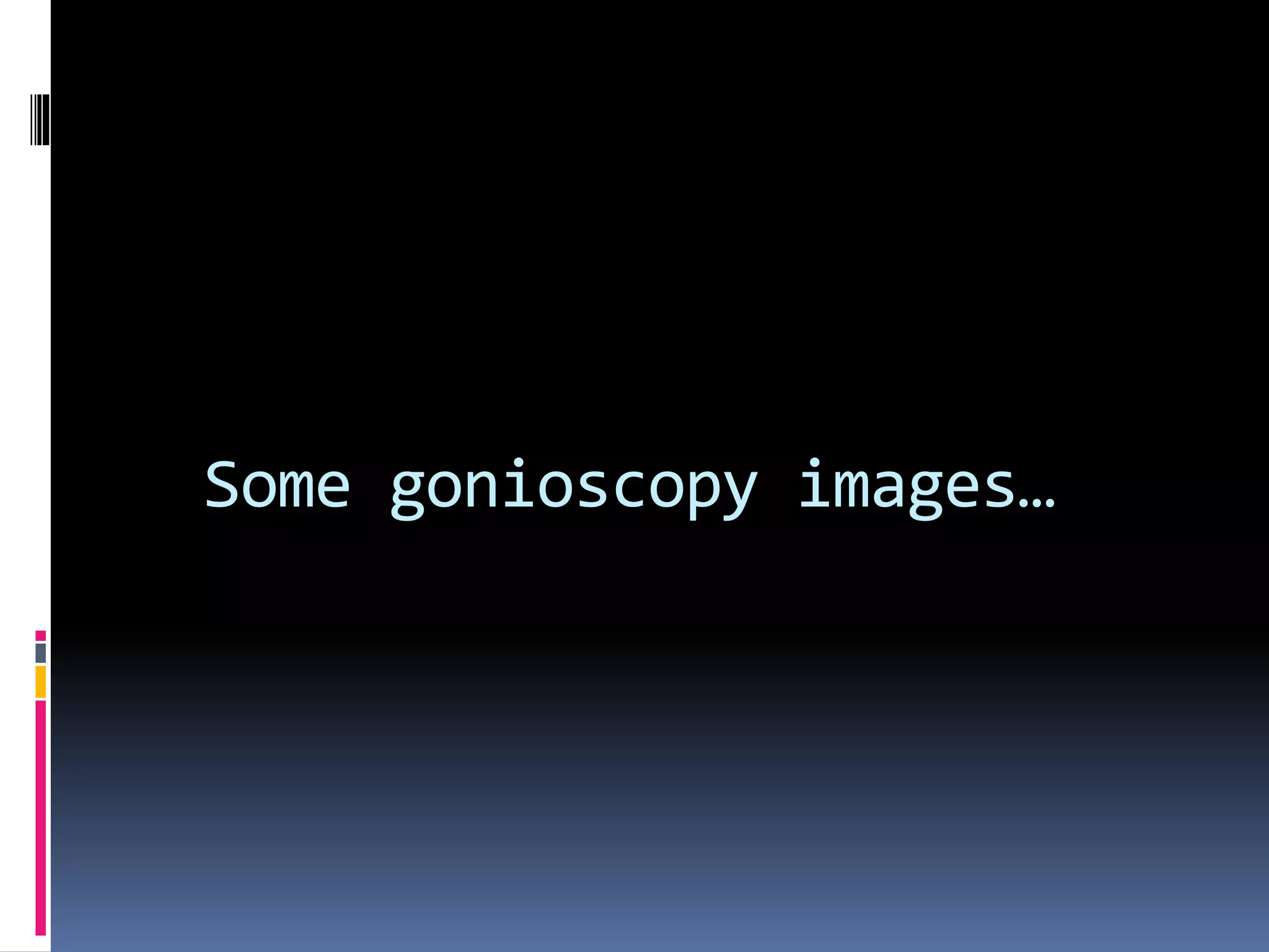 Some gonioscopy images…
 