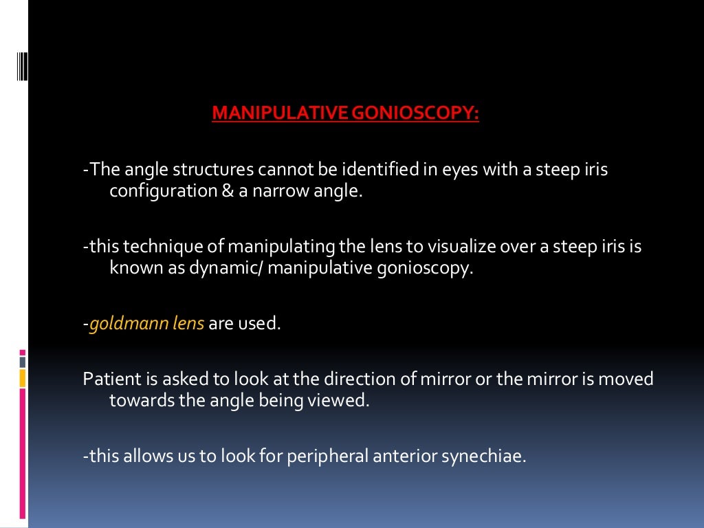 Gonioscopy gonioscopic lenses, principle and clinical aspects