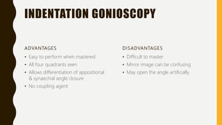 INDENTATION GONIOSCOPY
ADVANTAGES
• Easy to perform when mastered
• All four quadrants seen
• Allows differentiation of appositional
& synaechial angle closure
• No coupling agent
DISADVANTAGES
• Difficult to master
• Mirror image can be confusing
• May open the angle artificially
 