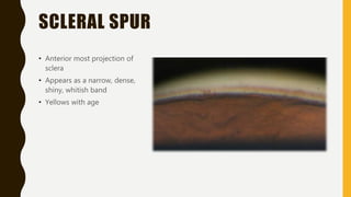 SCLERAL SPUR
• Anterior most projection of
sclera
• Appears as a narrow, dense,
shiny, whitish band
• Yellows with age
 