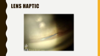 LENS HAPTIC
 