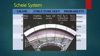 Scheie Classification System Gonioscopy | PPTX