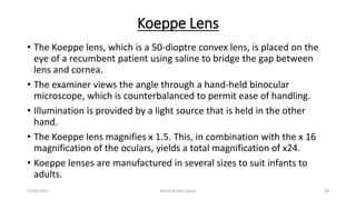 Koeppe Lens
• The Koeppe lens, which is a 50-dioptre convex lens, is placed on the
eye of a recumbent patient using saline to bridge the gap between
lens and cornea.
• The examiner views the angle through a hand-held binocular
microscope, which is counterbalanced to permit ease of handling.
• Illumination is provided by a light source that is held in the other
hand.
• The Koeppe lens magnifies x 1.5. This, in combination with the x 16
magnification of the oculars, yields a total magnification of x24.
• Koeppe lenses are manufactured in several sizes to suit infants to
adults.
13-03-2020 Kartik Kumar Gupta 39
 