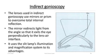 Indirect gonioscopy
• The lenses used in indirect
gonioscopy use mirrors or prism
to overcome total internal
reflection.
• The mirror redirects light from
the angle so that it exits the eye
perpendicularly to the lens-air
interface.
• It uses the slit lamp’s illumination
and magnification system to its
advantages.
13-03-2020 Kartik Kumar Gupta 48
 