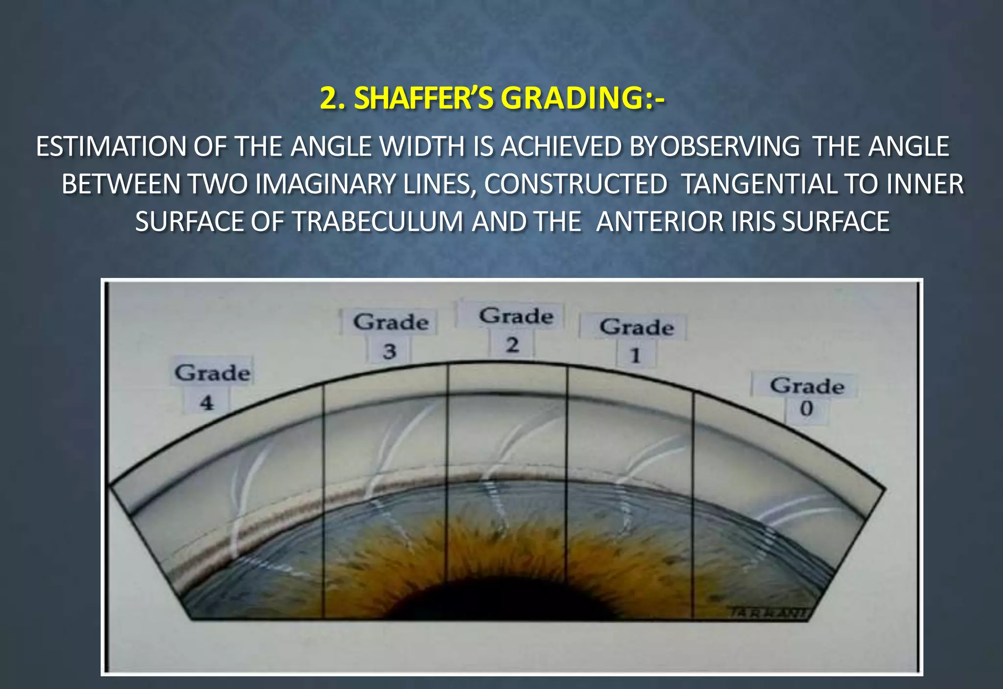 2. SHAFFER’S GRADING:-
ESTIMATION OF THE ANGLE WIDTH IS ACHIEVED BYOBSERVING THE ANGLE
BETWEEN TWO IMAGINARY LINES, CONSTRUCTED TANGENTIAL TO INNER
SURFACE OF TRABECULUM AND THE ANTERIOR IRIS SURFACE
 