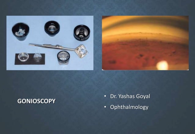 Gonioscopy | PPT