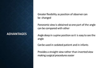 ADVANTAGES
Greaterflexibility asposition of observercan
be changed
Panoramicviewis obtained soonepart of the angle
can becompared with other
Angledeepin supine position soit is easytosee the
angle
Canbeused in sedated patient and in infants
Providesa straight viewrather than invertedview
makingsurgicalprocedureseasier
 